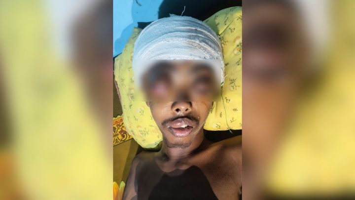 সাভারে নির্যাতনের শিকার কিশোর চোখে দেখতে পাচ্ছে না, ছাত্রদল নেতা বহিষ্কার