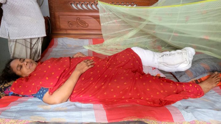 সরকারি চিকিৎসক ক্লিনিকের মালিক, পায়ে অস্ত্রোপচারের পর ড্রিলের ফলা রেখেই করলেন সেলাই